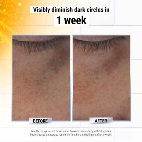 Dermatologist Solutions Powerful-Strength Line-Reducing & Dark Circle-Diminishing Vitamin C Eye Serum 15ml/0.5oz