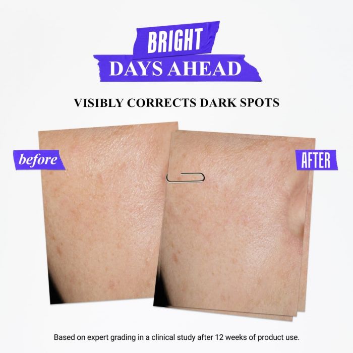 Clearly Corrective Dark Spot Solution 1 Fl Oz